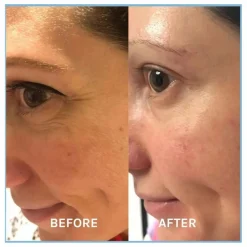 Discount Evolve Sérum anti-âge Defying Lifting - 30 ml Non teinté